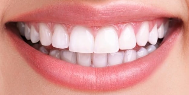 Bembeyaz dişlere sahip olmak çok kolay