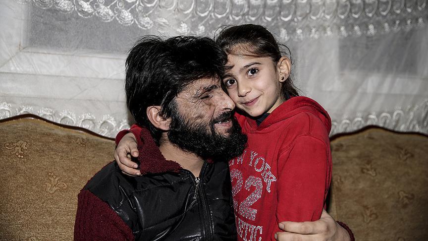 ''Benim gözlerimi alıp babama verin. O görsün ve beni sevsin''