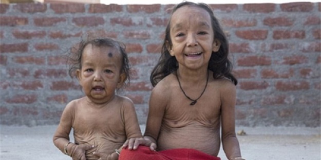 'Benjamin Button' çocuklar - FOTO