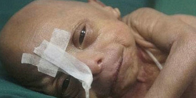 Bangladeş'te Benjamin Button gerçek oldu