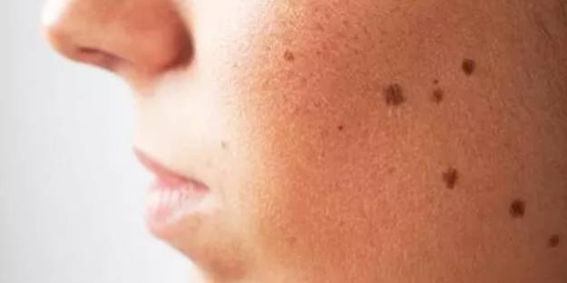 Ben’leriniz için doğal yollara başvurun