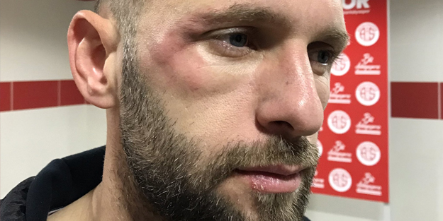 Beşiktaş maçında darbe alan Hakan Özmert isyan etti: Yetkililere seslenmek istiyorum...