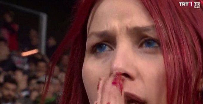 Beşiktaş'ın kırmızı saçlı taraftarı konuştu