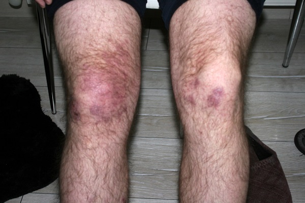 Betonu temizlemek isterken sağlığından oldu