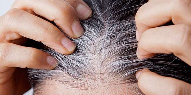 Beyaz saçlardan kurtulmanın en doğal yolu! 1 saat bekletin olanları görünce şaşıracaksınız