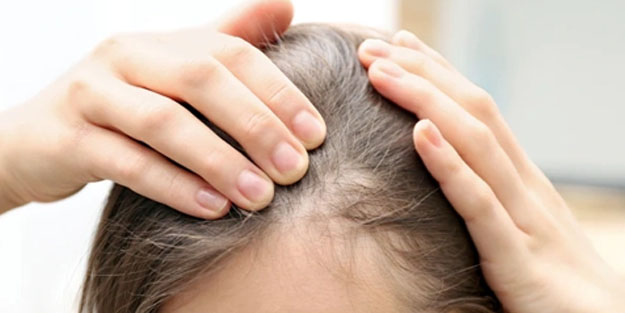 Beyaz saçları bu şey oluk oluk saç çıkarıyor! Saç boyasına son,