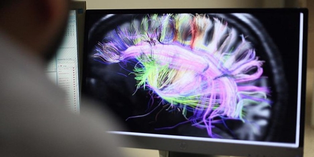 Beyin ile ilgili kritik keşif yapıldı