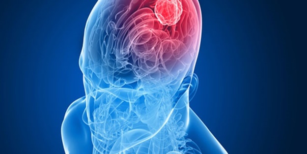 'Beyin ölümünün geri dönüşü yok'