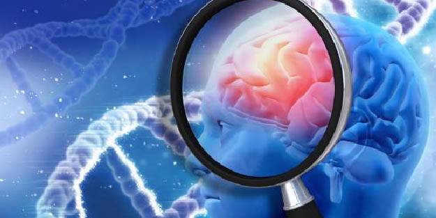 Beyin tümörü belirtileri nedir? Beyin tümörünün 10 önemli belirtisine dikkat!