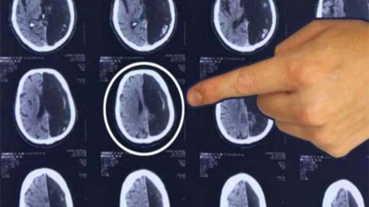 Beyinde “hafıza sıfırlama düğmesi” keşfedildi!