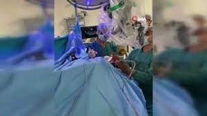 Beynindeki tümör "konuşarak" çıkarıldı