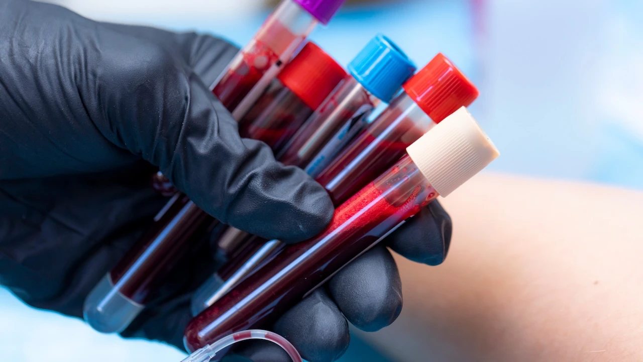 Bilim dünyası şokta: Yeni bir kan grubu keşfedildi!