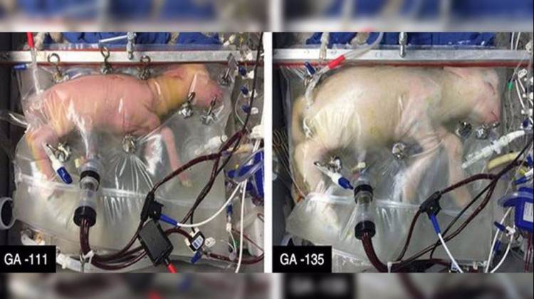 Bilim insanları yapay rahim geliştirdi!