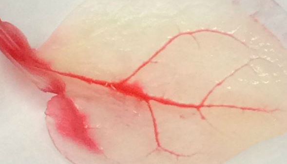 Bilim insanlarından inanılmaz başarı. Ispanaktan insan kalbi üretildi!