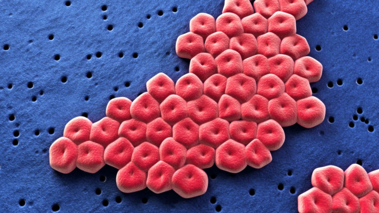 Bilim insanlarından korkutan uyarı! Antibiyotik dirençli ölümcül bakteri tespit edildi