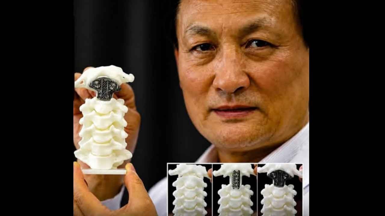 Bilim kurgu değil gerçek! 3D yazıcı ile insana yeni omurga üretildi!