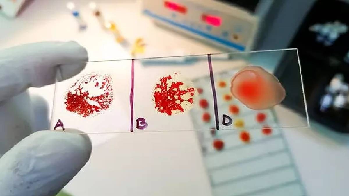 Bilimsel olarak kanıtlandı! Bu kan grubundaki kişiler yüksek IQ’ya sahip! İşte en zeki kan grupları