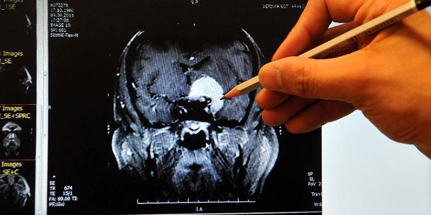 Bilimsel veri: Kadınların beyinleri erkeklerinkinden daha aktif