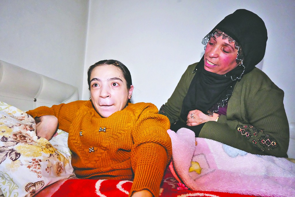Bilnaz anne felçli kızına bebek gibi bakıyor
