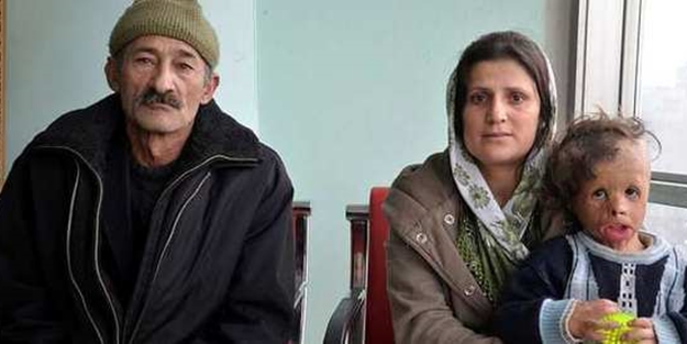 'Mahalledeki çocuklar oğlumdan kaçıyor'