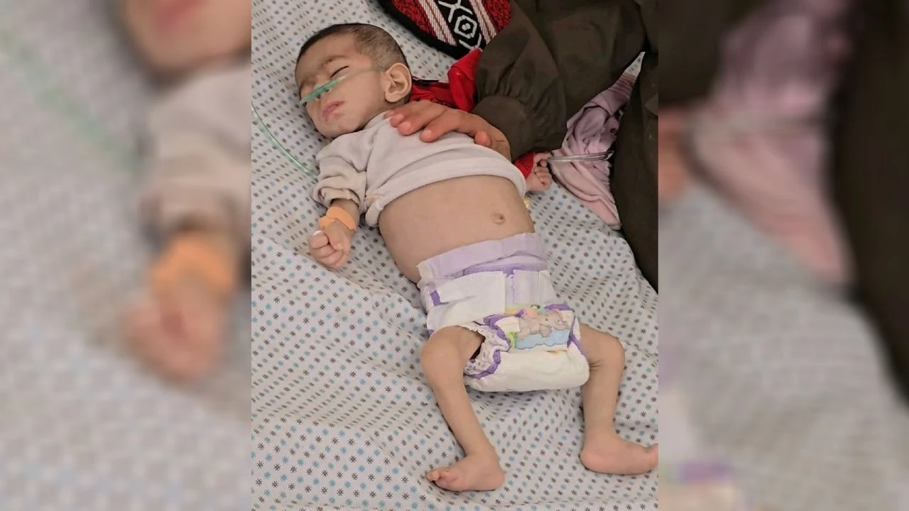 Bir bebek açlıktan şehit oldu!