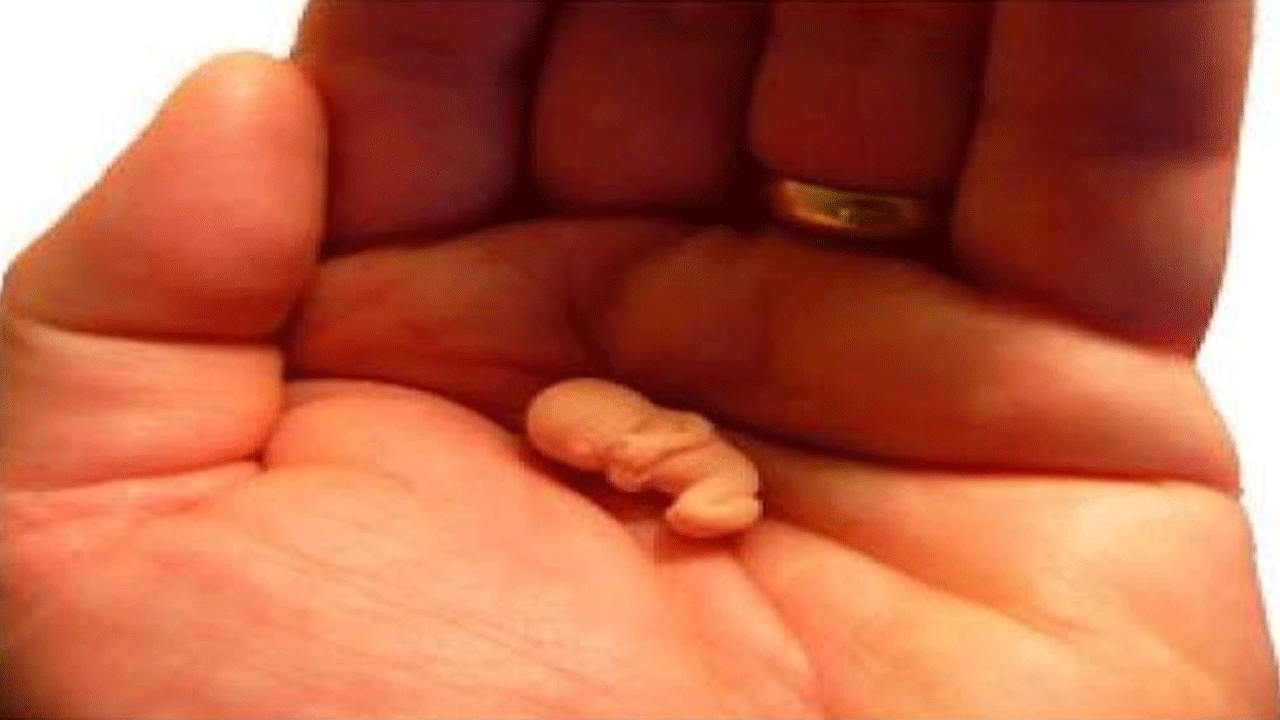 Bir bu eksikti.. ABD Sağlık Bakanı ifşa etti: Aşılarda cenin kullanılıyormuş!