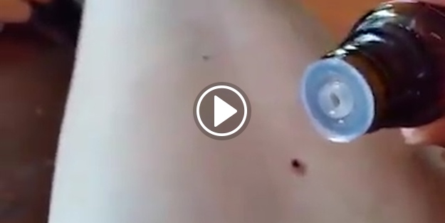 Bir damla döktü! Kene adeta kaçtı!