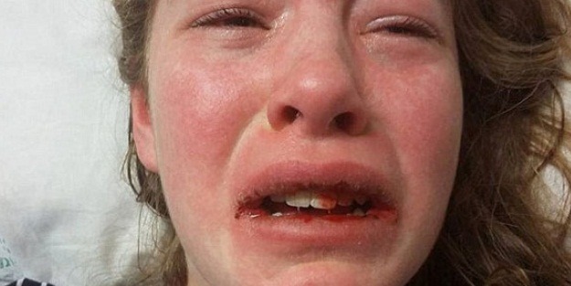 Bir ısırık hayatını kararttı!