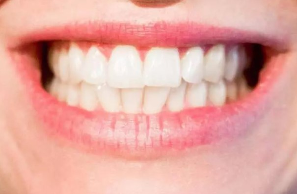 Bir ısırık ne kadar tehlikeli olabilir? İşte dünyanın en güçlü çeneye sahip canlıları