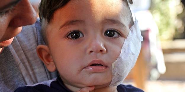 Bir Pitbull vahşeti daha! Minik çocuğun yanağını ve kulağını kopardı