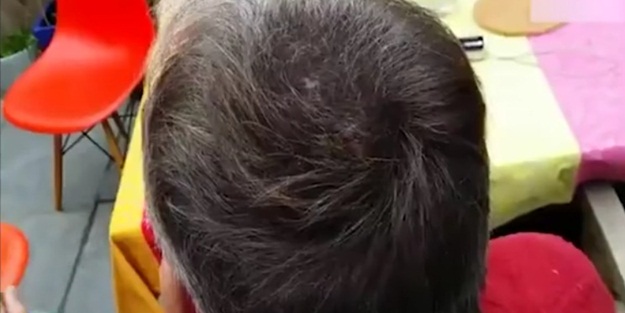 Bir saniyede kel kaldı