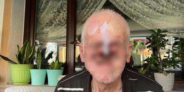 Bir sivilceyle başladı! Burnu milim milim eridi