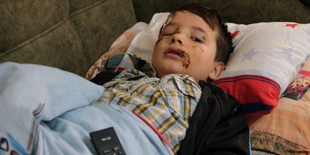 Bir sokak köpeği dehşeti daha! Yüzüne tam 60 dikiş atıldı