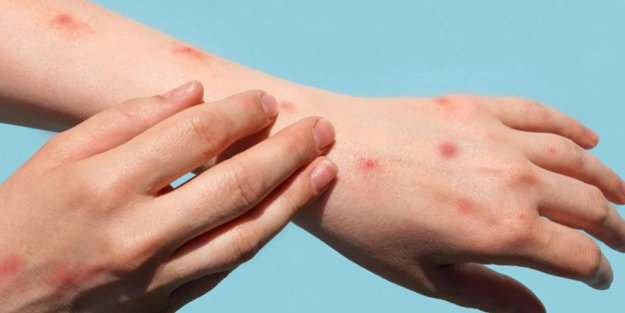 Bir ülke daha duyurdu! Yeni virüsün görüldüğü ülke sayısı 20'ye çıktı!