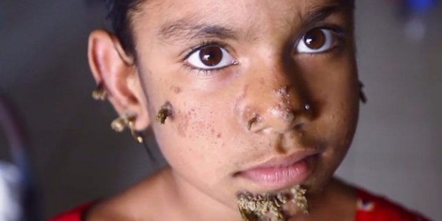 Birden yüzünde çıkmaya başladılar!