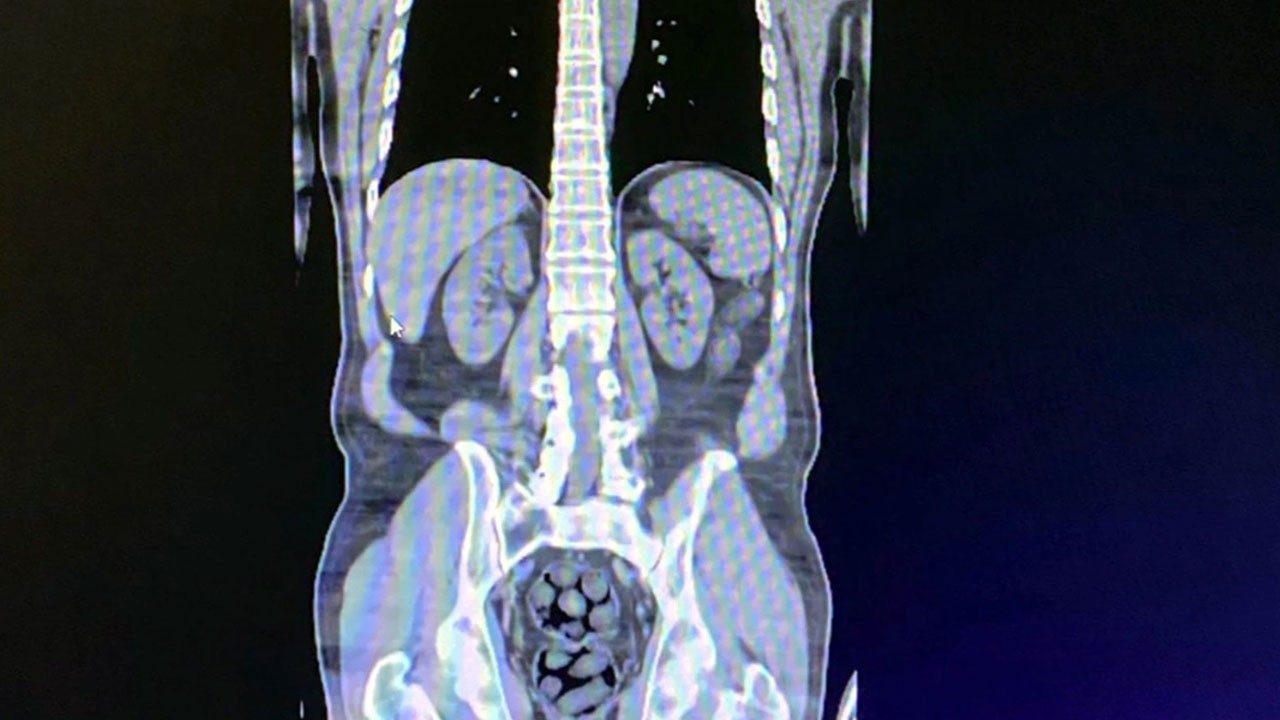 Bitlis'te, İranlıların iç organlarından çıkanlar ağızları açık bıraktı!
