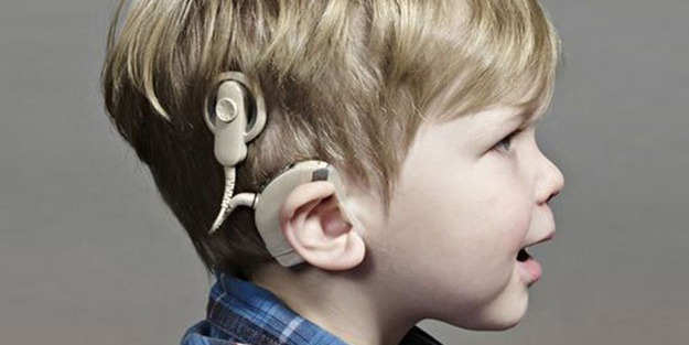 Biyonik kulak ameliyatında yaş sınırı var mı? İşitme kaybının erken tespiti çok önemli…