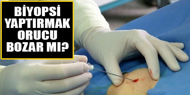 Biyopsi yaptırmak orucu bozar mı