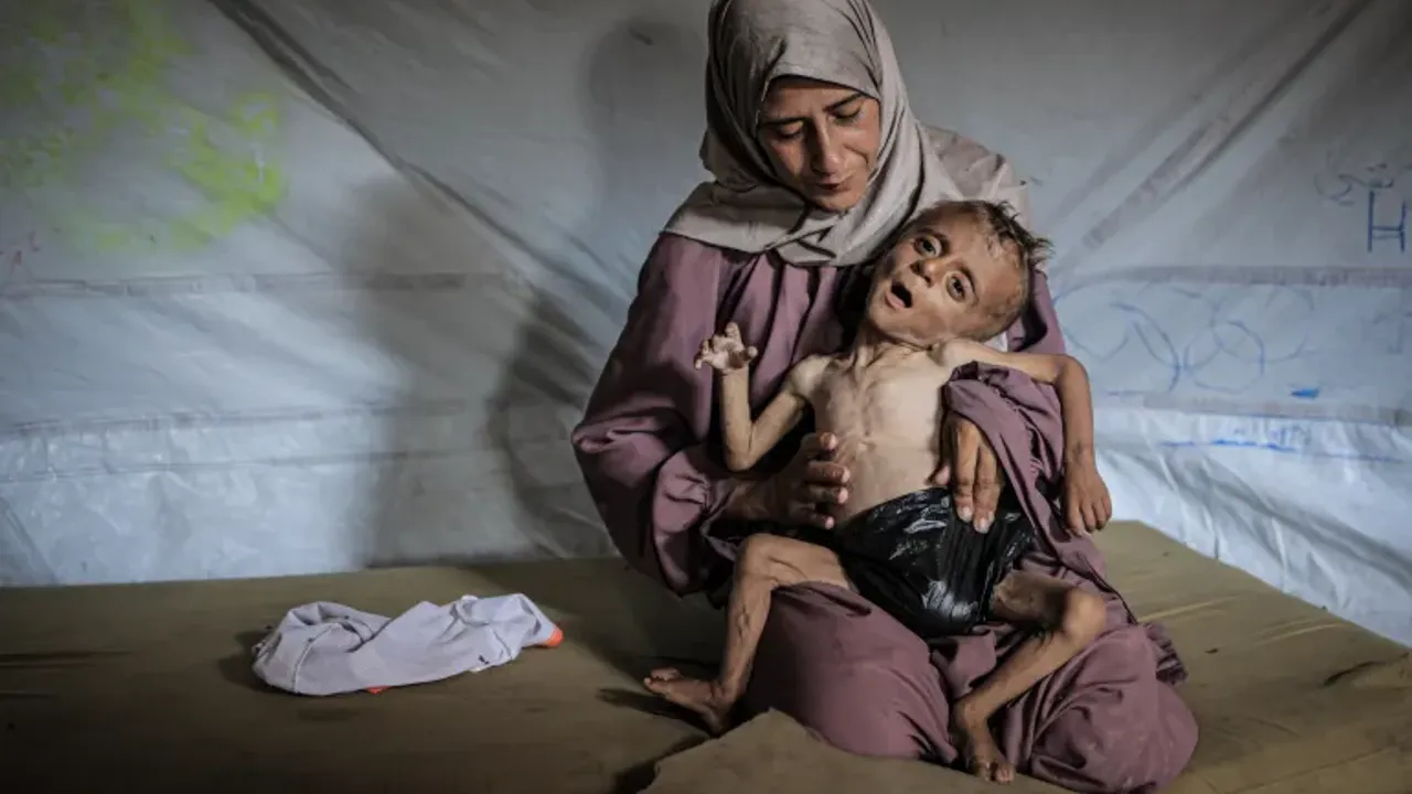 BM: 'Gazze'de her üç çocuktan biri 24 saattir yemek yemiyor!'