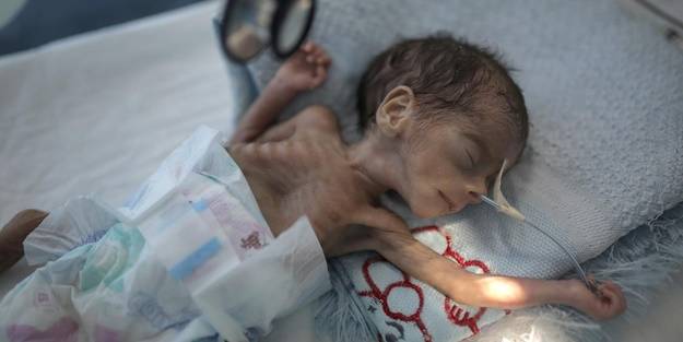 BM kötü haberi duyurdu! 'Finansman sağlanmazsa 8 milyon Yemenliye yardımı keseceğiz'