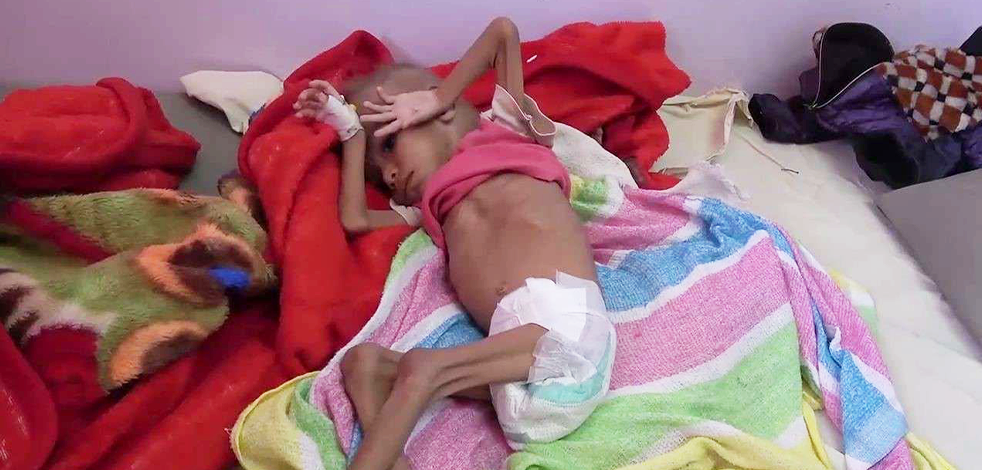 BM'den dikkat çeken Yemen raporu