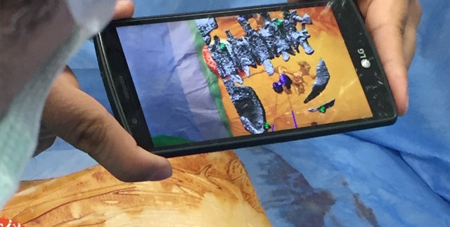 Böbrek ameliyatını artık 