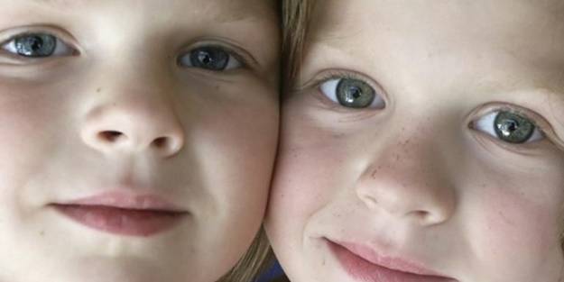 Böbrek naklinde ikizler daha şanslı