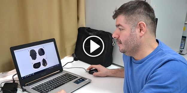 Böcek zırhından zayıflama hapı geliştirildi ​