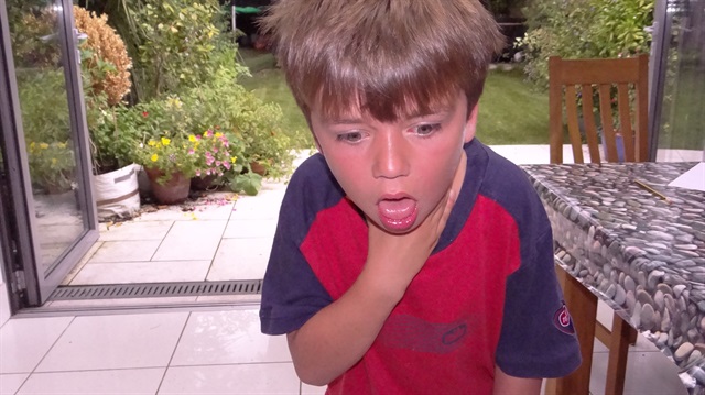 Boğaza kaçan yabancı cismi çıkarırken dikkat!