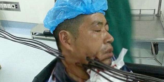 Boğazına demir çubuklar saplandı