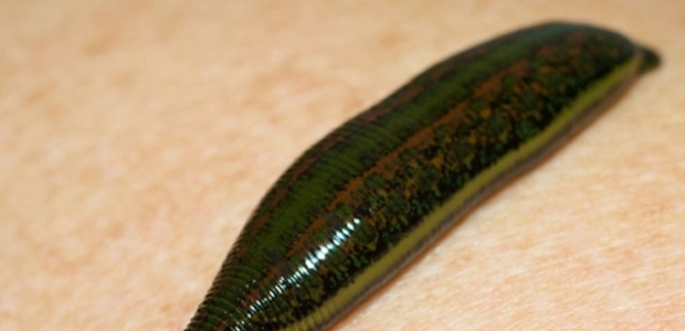 Boğazından sülük çıktı