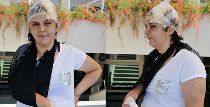 Boşanmak isteyen eşe şiddet: Kolu kırıldı, başına 50 dikiş atıldı