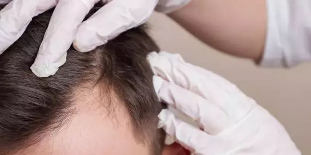 Boya değil bitkisel yağ! Beyaz saçları 1 gecede özüne döndüren İbn-i Sina önerisi! Dünyaca ünlü yağlar