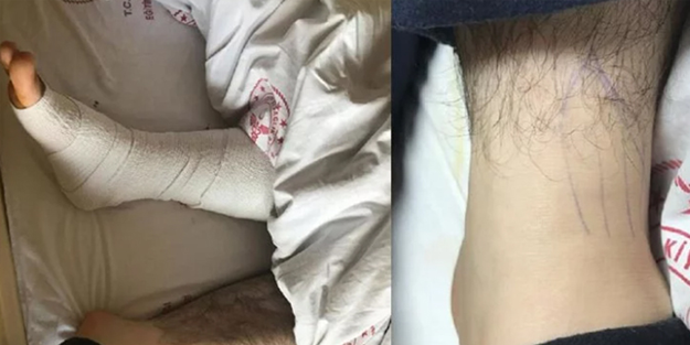 Böyle doktorları Almanya’ya postalayın! Sağlam ayağı ameliyat ettiler!